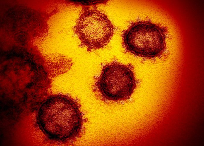 covid-19 coronavirus